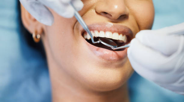 Best Dental Fillings (Composite and Amalgam)  in Leesport, PA